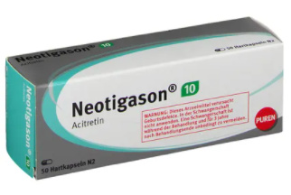 НЕОТИГАЗОН (ацитретин) / NEOTIGASON (Acitretin)